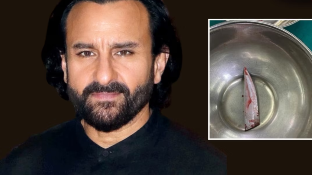 If the Knife Went 2 mm Deeper... Saif Ali Khan Survives Horrific Attack