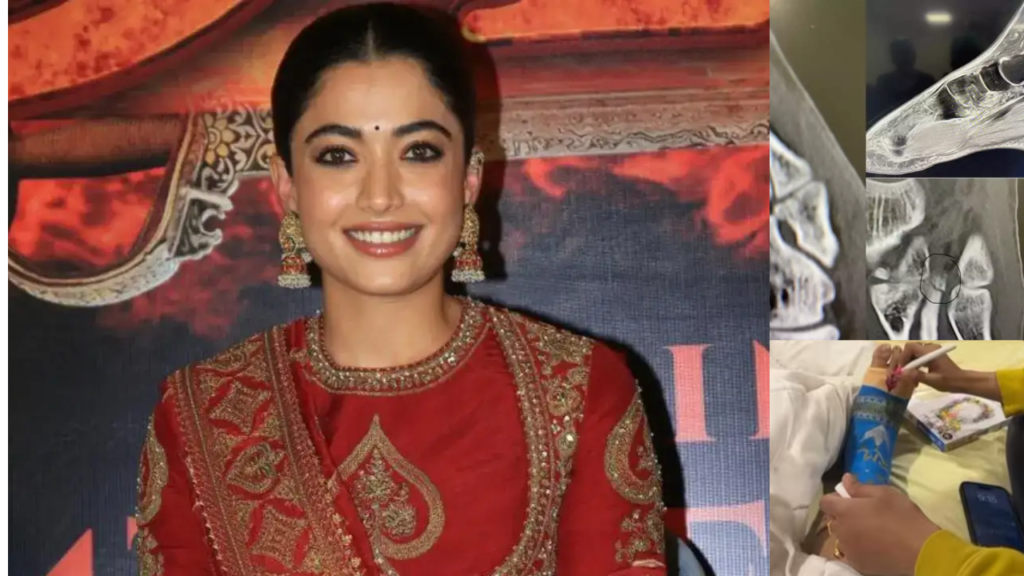 Rashmika Mandanna Reveals Serious Foot Injury at ‘Chhaava’ Trailer Launch